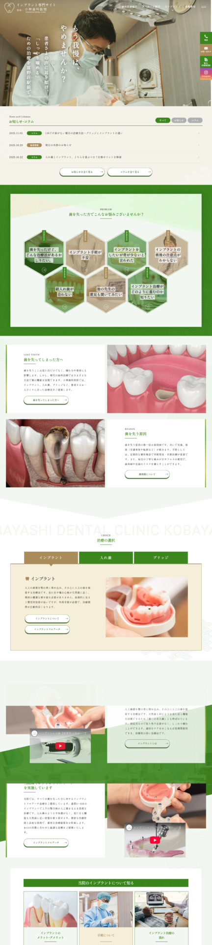 小林歯科医院 様【インプラント専門サイト】
