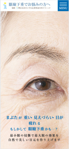 堺市北区のいずみ皮膚科形成外科クリニック 様【眼瞼下垂専門サイト】